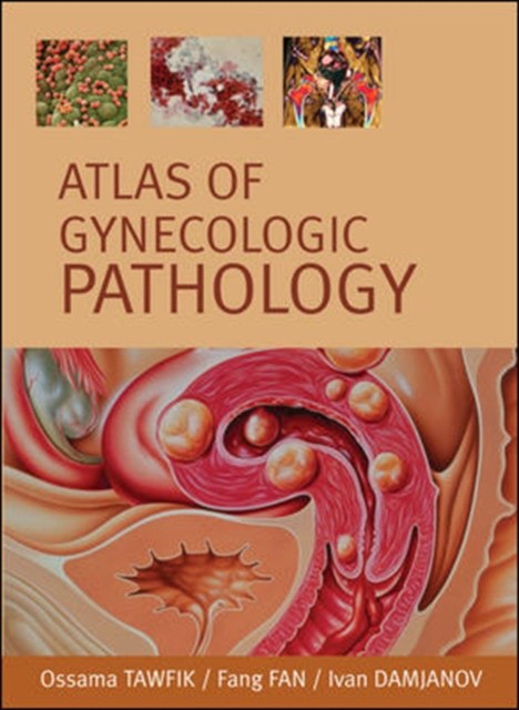 Tawfik Atlas of Gynecological Pathology. 2007 