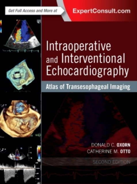 Oxorn Donald Intraoperative and Interventional Echocardiography 