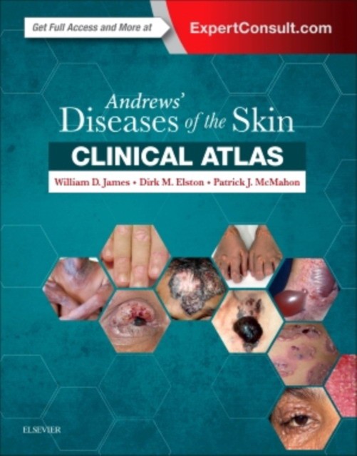 William D. James, Dirk Elston, Patrick J. McMahon Andrews' Diseases of the Skin Clinical Atlas 