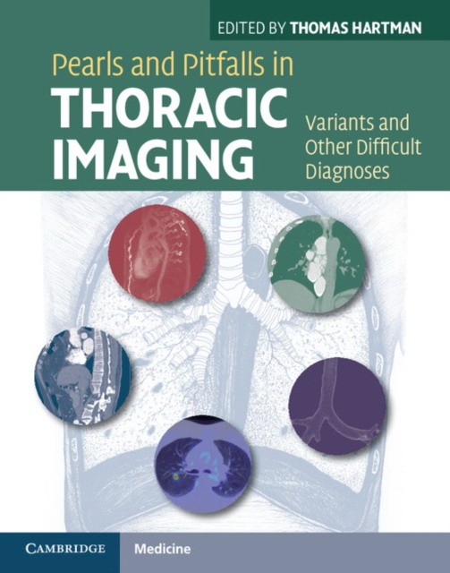 HARTMAN Pearls and Pitfalls in Thoracic Imaging 