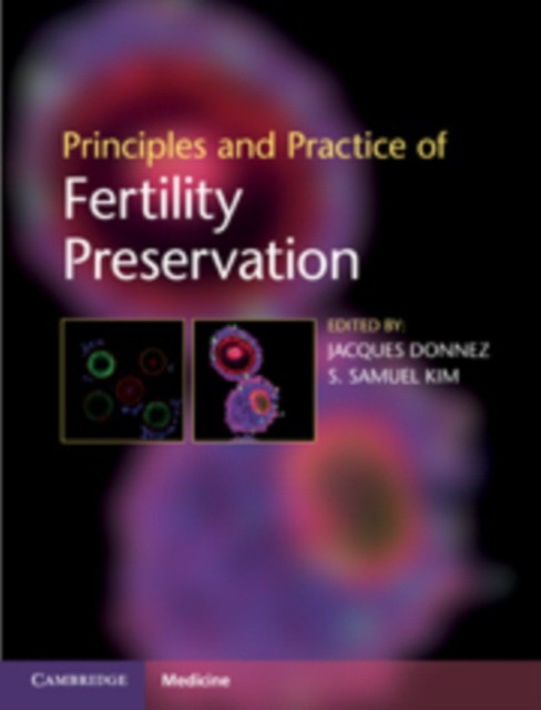 Donnez Principles and Practice of Fertility Preservation 