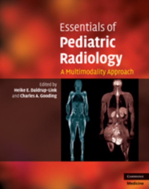 Daldrup-Link Essentials of Pediatric Radiology 