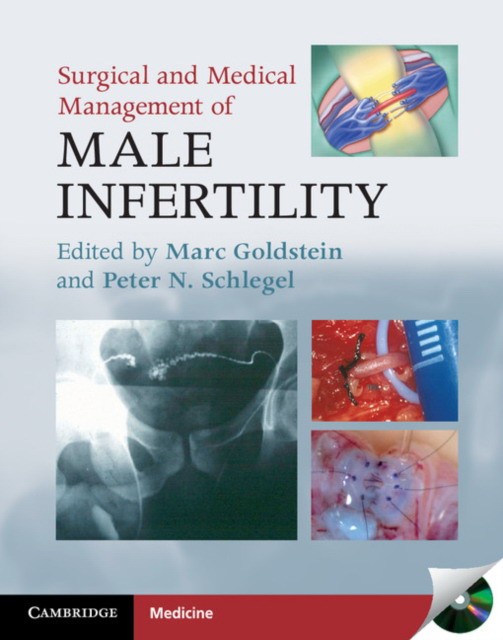 Goldstein Surgical and Medical Management of Male Infertility 