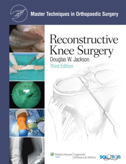 Jackson Mtos: recon knee surgery 3e cb 