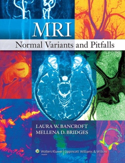 Bancroft MRI Normal Variants and Pitfalls 