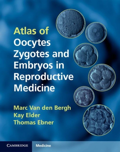 Van den Bergh Atlas of Oocytes, Zygotes and Embryos in Reproductive Medicine Hardback with CD 
