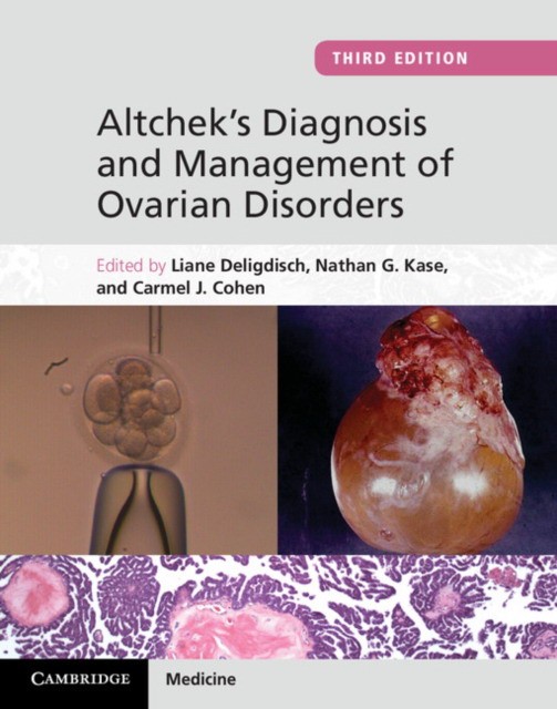 Deligdisch Altchek's Diagnosis and Management of Ovarian Disorders 
