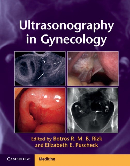 Rizk Ultrasonography in Gynecology 