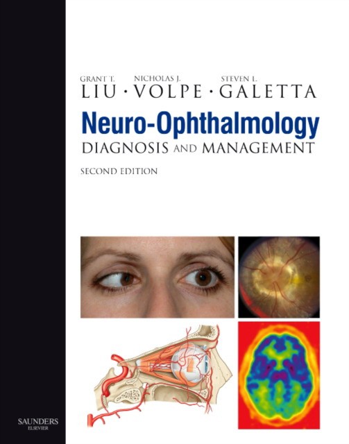 Grant T. Liu Neuro-Ophthalmology 