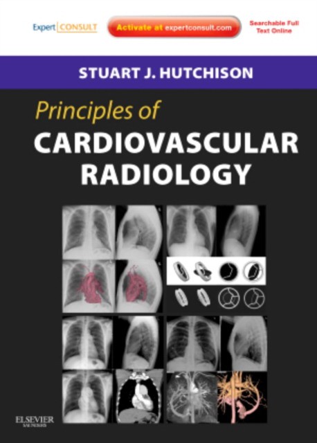 Stuart J. Hutchison Principles of Cardiovascular Radiology, 