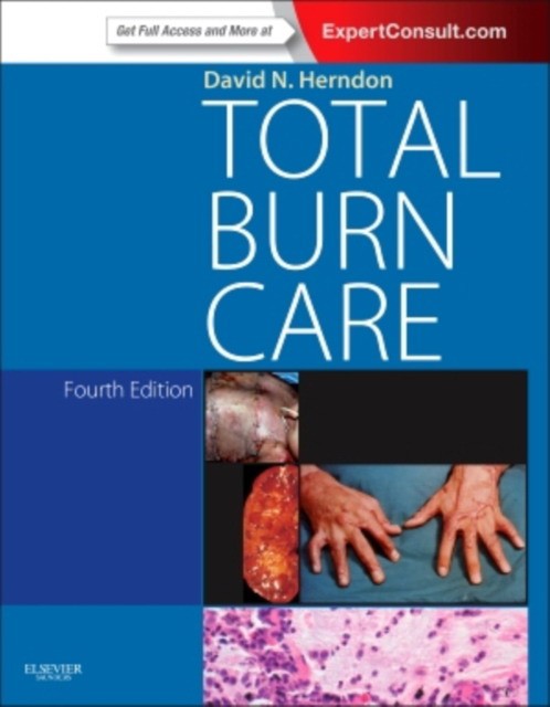 David N. Herndon Total Burn Care, 