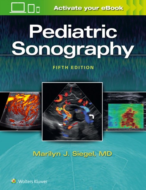 Siegel, Marilyn J. Pediatric sonography 