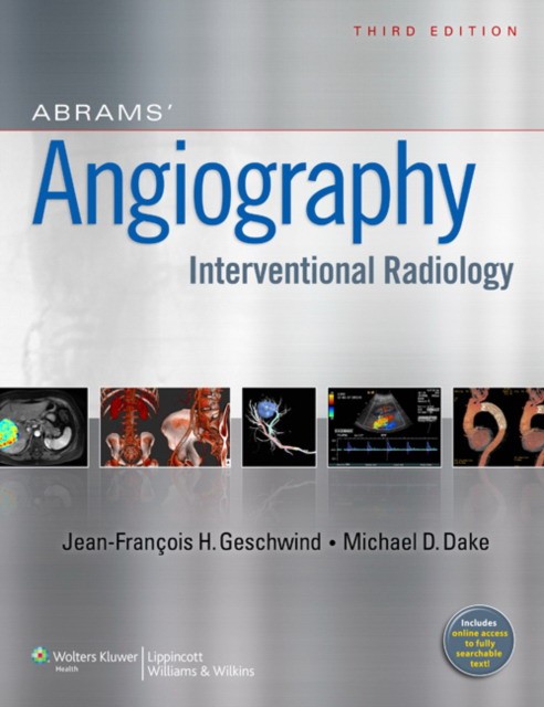 Geschwind Abrams Angiography 