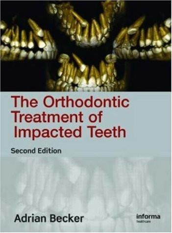 Becker Orthodontic Treatment Impacted Teeth 2E 