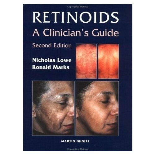 Lowe Retinoids [2nd Ed] 