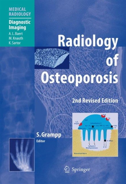 Grampp Radiology of Osteoporosis 