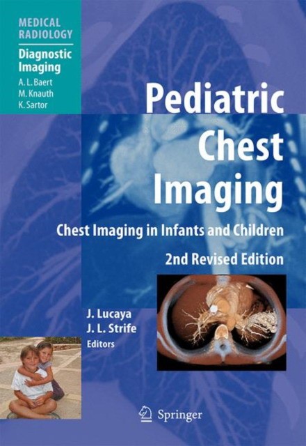 Lucaya Pediatric Chest Imaging 