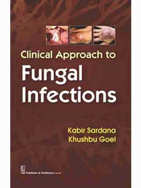 Sardana K. Clinical Approach To Fungal Infections 