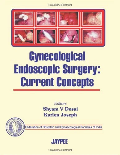 Desai Gynecology Endoscopic Surgery: Current Concepts 