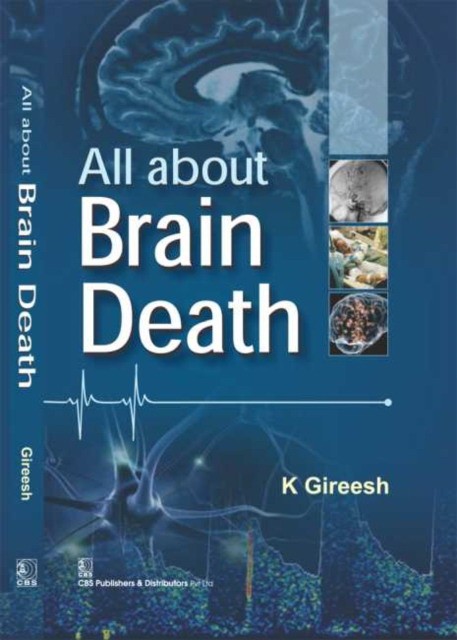Gireesh K All About Brain Death 