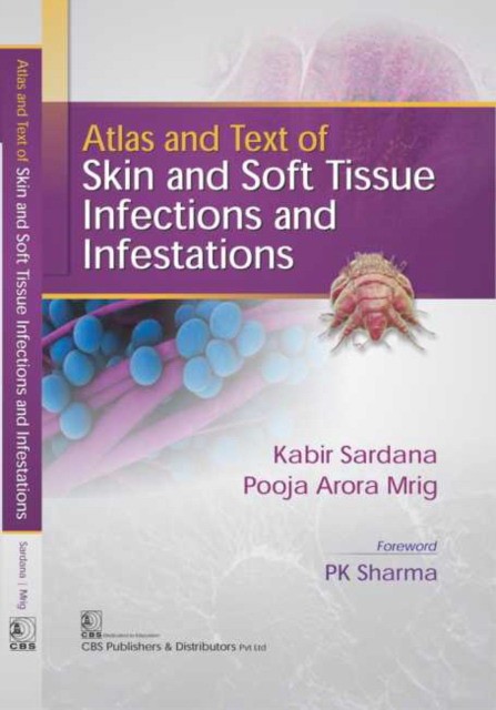 Sardana K. Atlas And Text Of Skin And Soft Tissue Infections And Infestations 