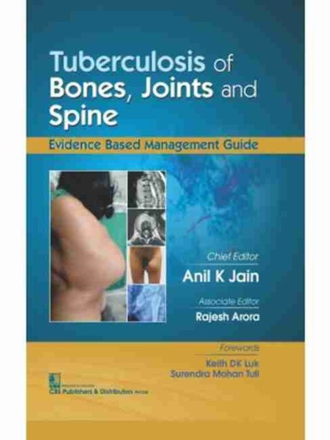 Jain A K Tuberculosis Of Bones Joints And Spine 