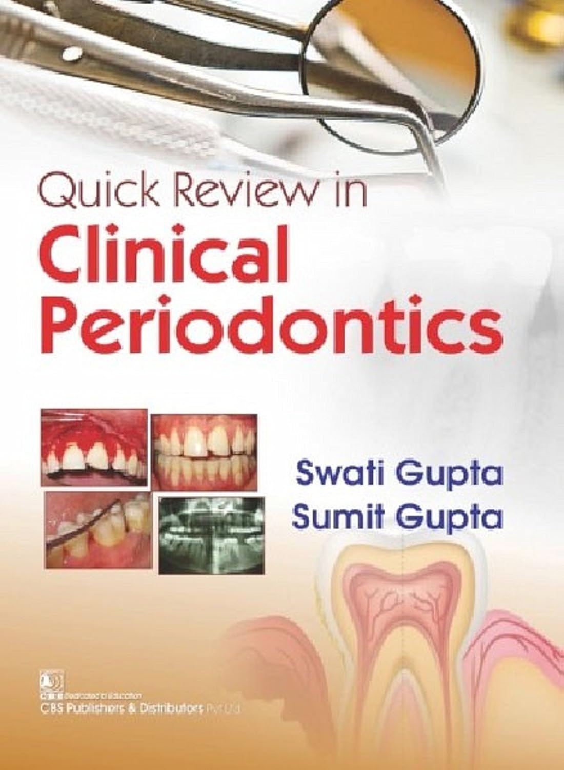 Gupta S Quick Review In Clinical Periodontics 