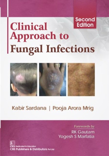Sardana K. Clinical Approach To Fungal Infections 2Ed 