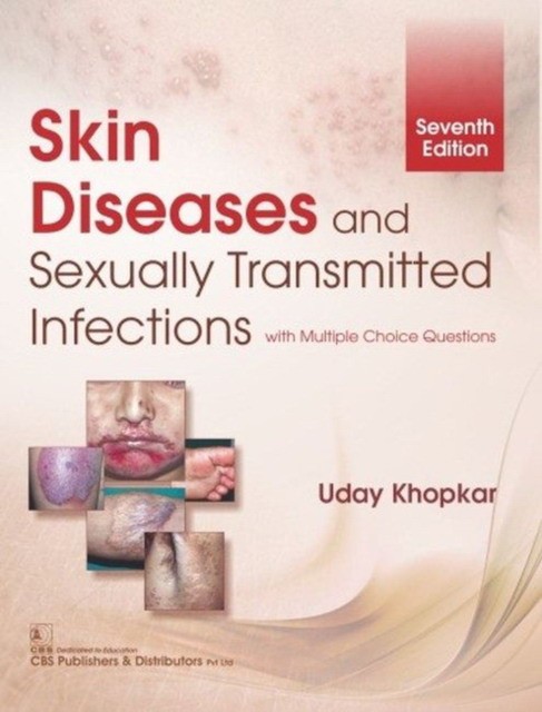Khopkar U. Skin Diseases And Sexually Transmitted Infections 