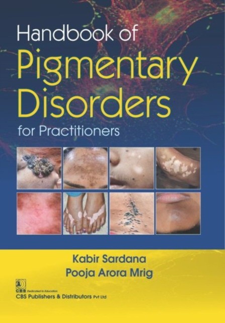 Sardana K. Handbook Of Pigmentary Disorders For Practitioners 