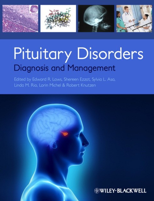 Laws Pituitary Disorders: Diagnosis and Management 