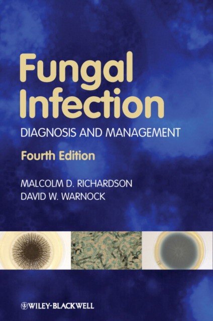 Richardson Fungal Infection: Diagnosis and Management, 4th Edition 
