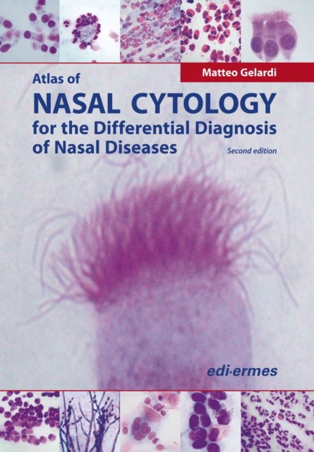 Matteo, Gelardi Atlas of nasal cytology for the differential diagnosis of nasal diseases 