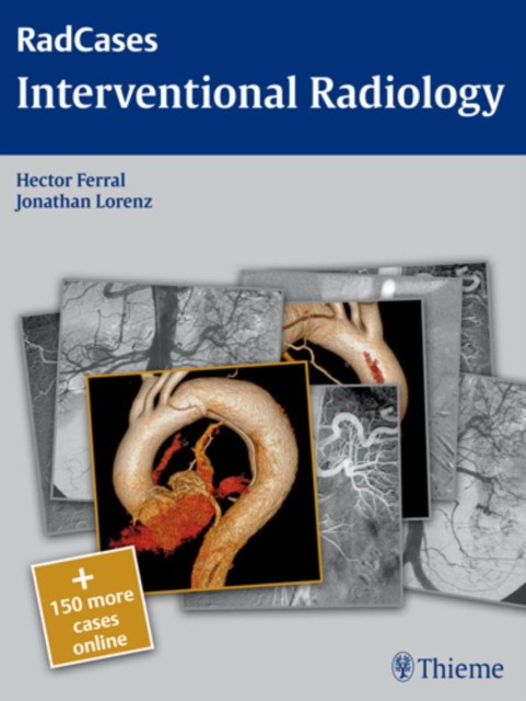 Hector Ferral Rad cases: Interventional Radiology 
