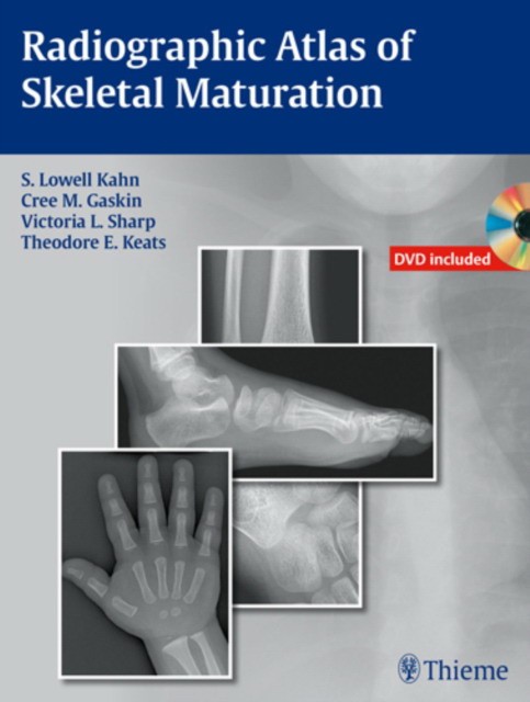 S. Lowell Kahn Radiographic Atlas of Skeletal Maturation 