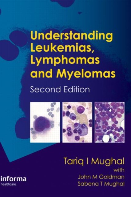 Tariq, Mughal Understanding Leukemias, Lymphomas and Myelomas, Second Edition 