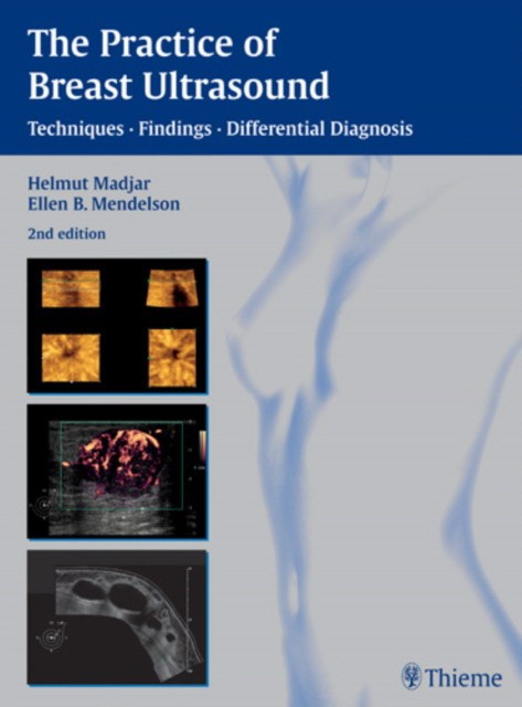 Helmut Madjar The Practice of Breast Ultrasound: Techniques, Findings, Differential Diagnosis 