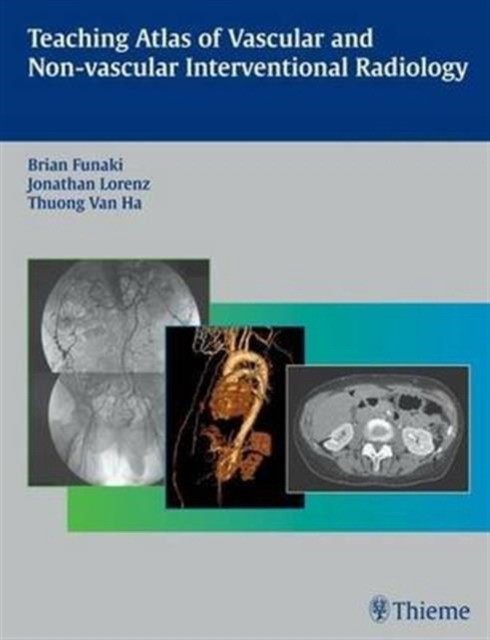 Brian Funaki Teaching Atlas of Vascular and Non-vascular Interventional Radiology 