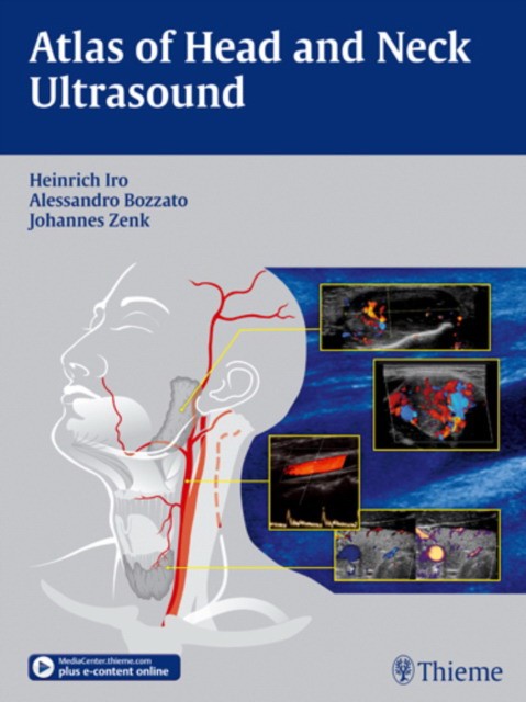 Heinrich Iro Atlas of Head and Neck Ultrasound 