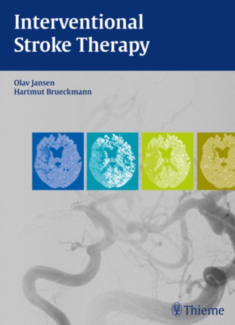 Olav Jansen Interventional Stroke Therapy 