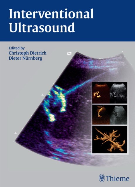 Christoph Frank Dietrich Interventional Ultrasound: A Practical Guide and Atlas 