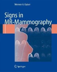 Kaiser Signs in MR-Mammography 