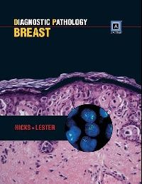 Lester Diag pathology breast amirsys cb (  ) 