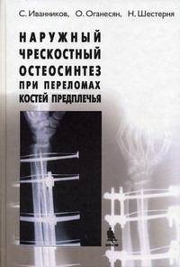 Иванников - Наружный чрескостный остеосинтез при переломах предплечья 