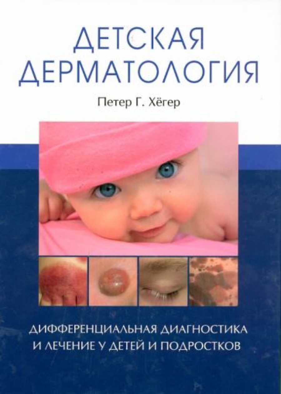 Хегер П.Г. Детская дерматология. Дифференциальная диагностика и лечение у детей и подростков 