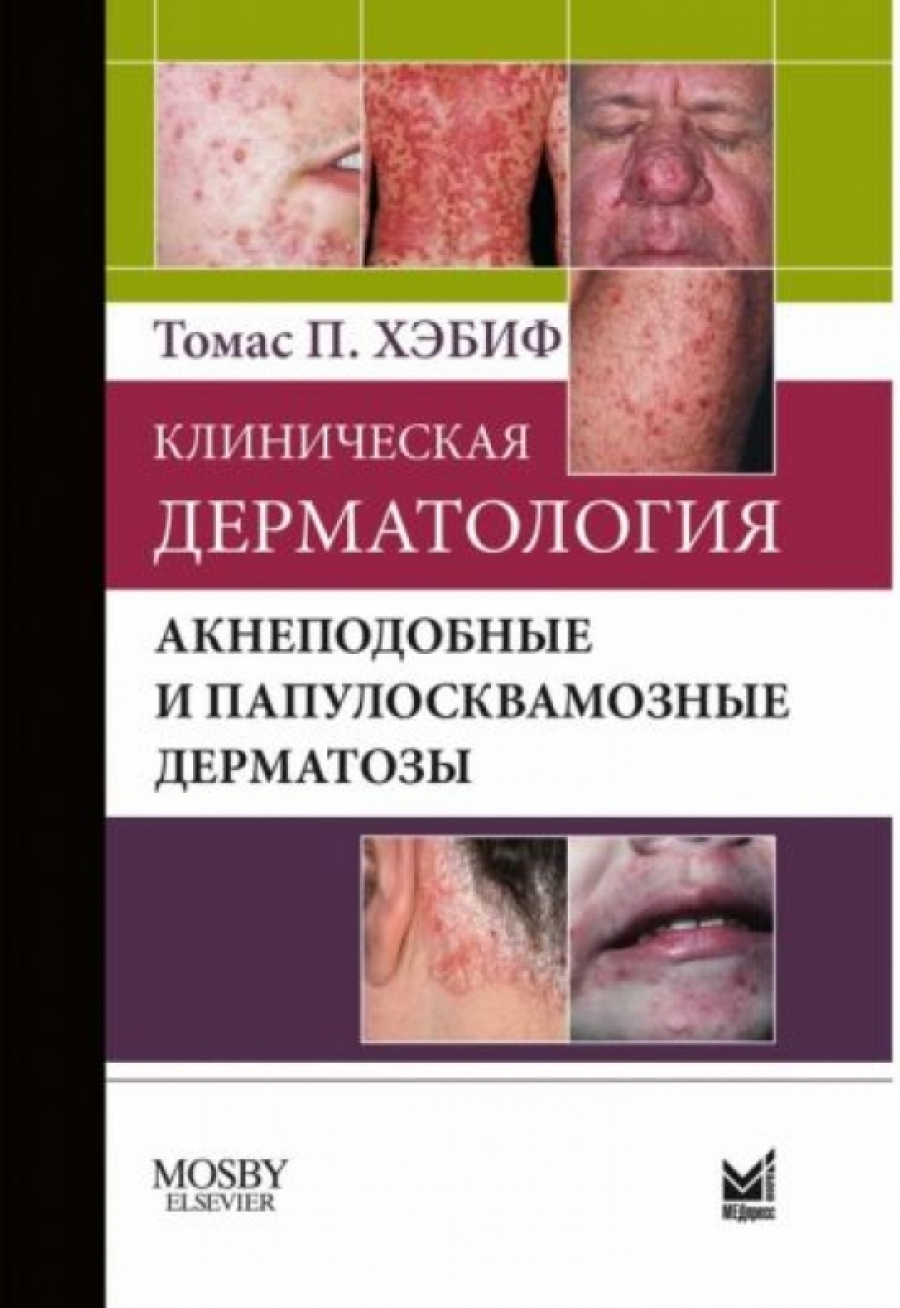 Хэбиф Т.П. Клиническая дерматология. Акнеподобные и папулосквамозные дерматозы 