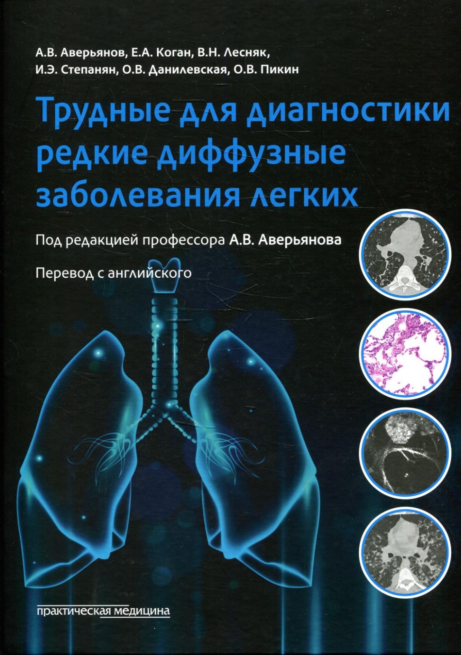 Аверьянов А.В. Трудные для диагностики редкие диффузные заболеваниях легких: монография 
