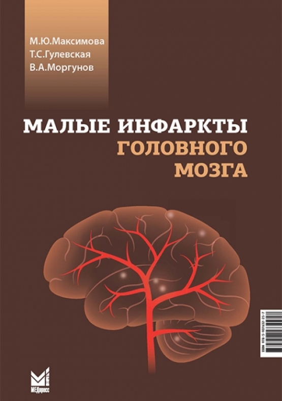 Максимова М.Ю. Малые инфаркты головного мозга 