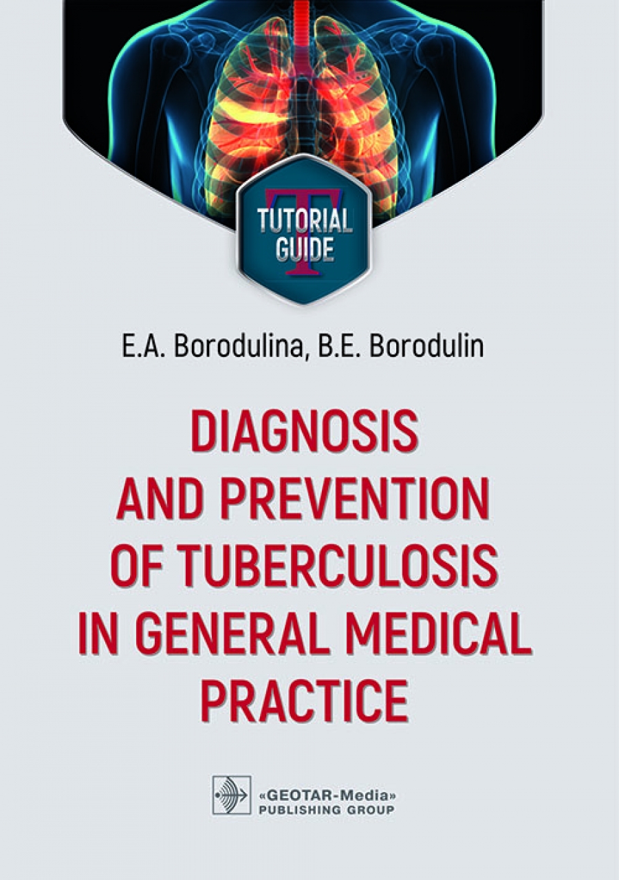  ..,  .. Diagnosis and prevention of tuberculosis in general medical practice : tutorial guide 
