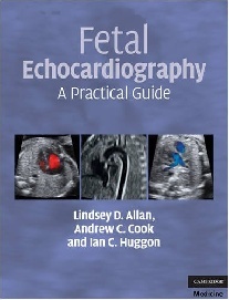 Ian, Allan, Lindsey D. Cook, Andrew Huggon Fetal echocardiography 